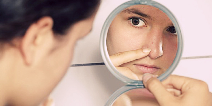 5 Tips Menghilangkan Komedo dengan Mudah di Rumah