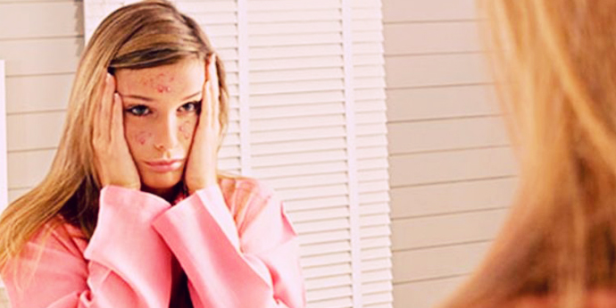 6 Fakta Tentang Jerawat yang Wajib Kamu Tahu Sekarang Juga!